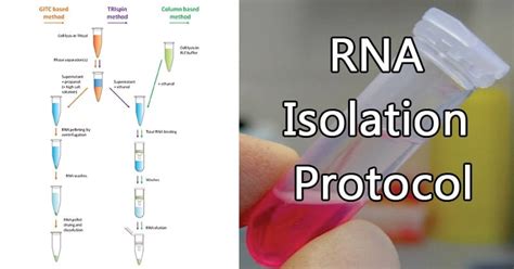 RNA isolation and protocol for cells in culture .